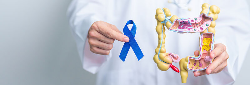 Screening del tumore del colon nelle IBD